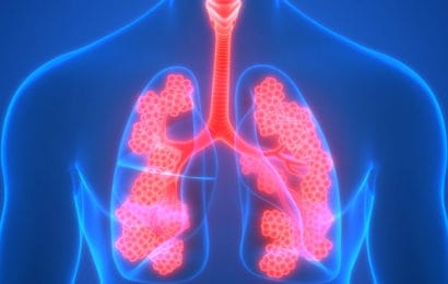 Lớp Quản lý hen – COPD trong cộng đồng