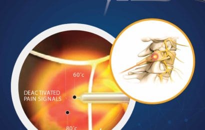 Lớp điều trị can thiệp đau mạn tính bằng sóng cao tần cơ bản, khóa 5