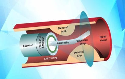 Lớp Siêu âm trong lòng mạch IVUS, khóa 8