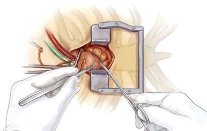 Lớp Phẫu thuật tim ít xâm lấn